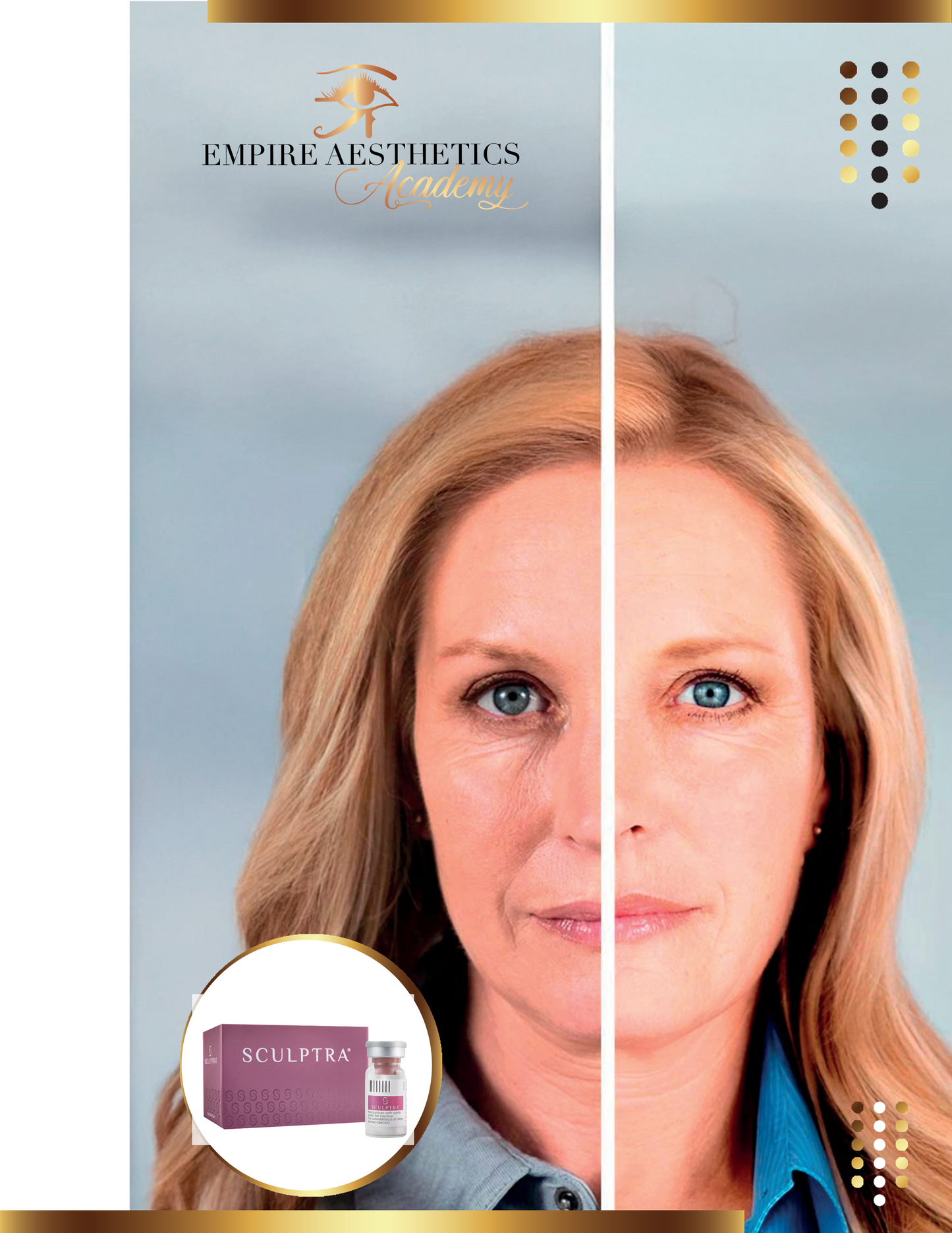 BIOESTIMULACION CON COLAGENO (SCULPTRA)