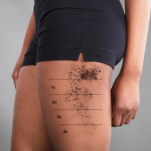 ENTRENAMIENTO PARA ELIMINAR TATUAJES CON BORRADOR DORADO