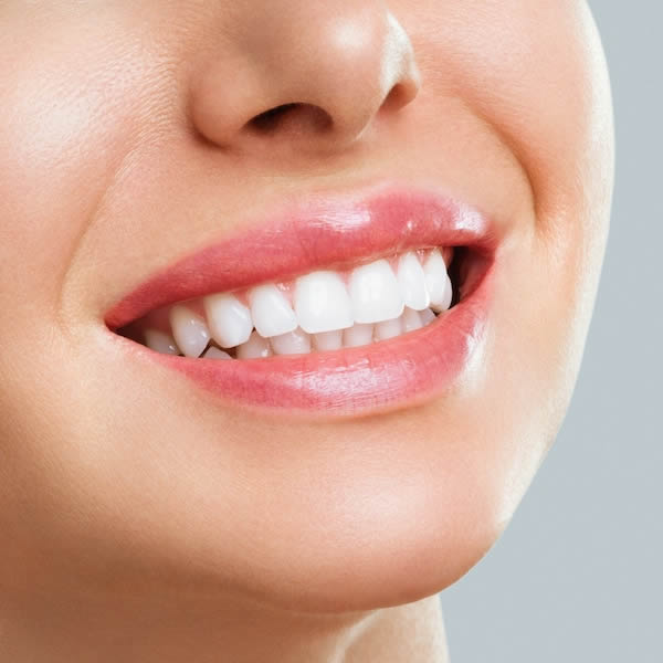 CURSO DE BLANQUEAMIENTO DENTAL