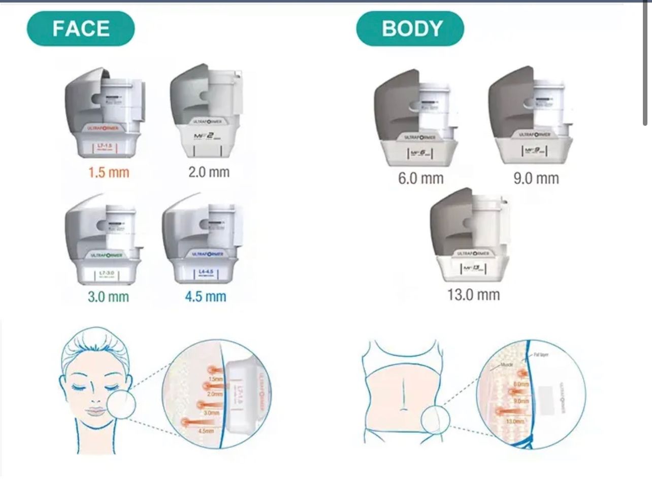 HIFU MACHINE