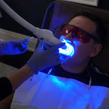 TEETH WHITENING TRAINING